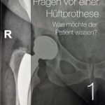 Dr. Moser hüftspezialist in berlin erklärt „was möchte ein Patient vor einer Hüftprothese wissen“