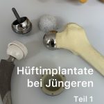 Hüftimplantate bei Jüngeren
