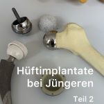 Hüftimplantate bei Jüngeren Teil 2