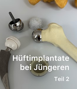 Hüftimplantate bei Jüngeren Teil 2