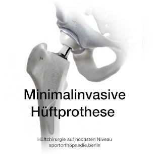 Minimalinvasive Hüftprothese