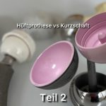 Hüftspezialist Dr Alexander Moser in Berlin erklärt Unterschied zwischen Oberflächenersatz der Hüfte ReCerf im Vergleich zur Hüftprothese